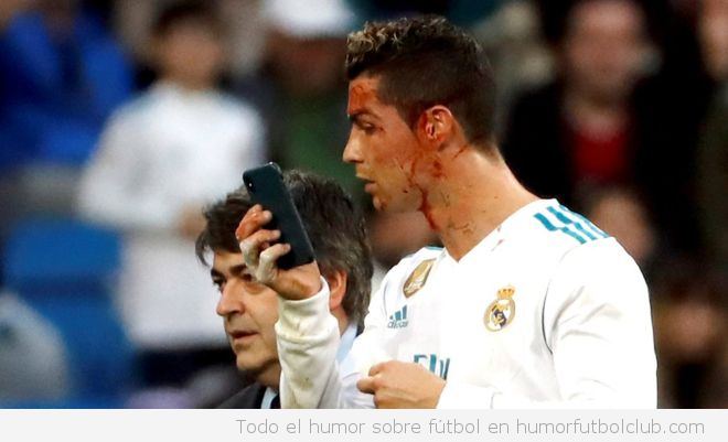 Cristiano Ronaldo se mira en el móvil la sangre en la cara