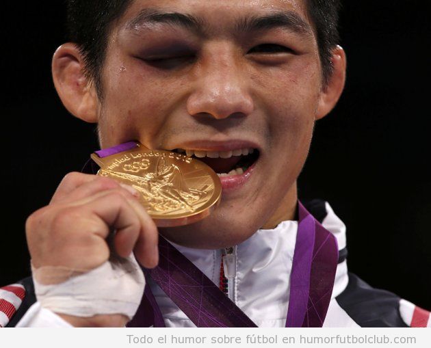 El luchador de lucha grecorromana surcoreano, Hyeonwoo Kim, con un ojo morado mordiendo la medalla de oro en JJOO 2012
