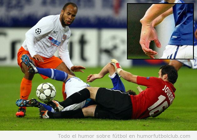 Julian Draxler lesión de muñeca con el Schalke