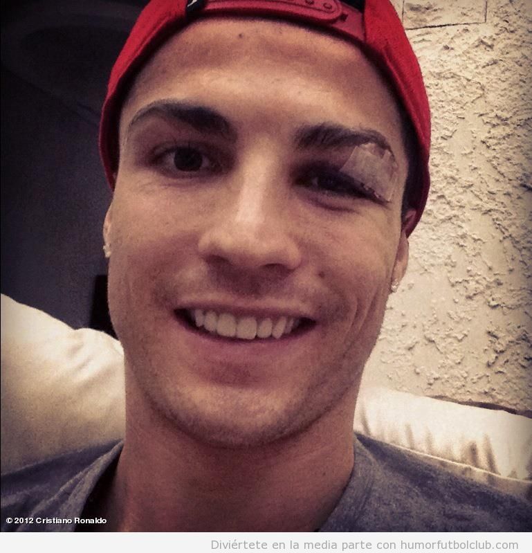 Foto de Cristiano Ronaldo en Facebook sobre la recuperación de su ceja rota