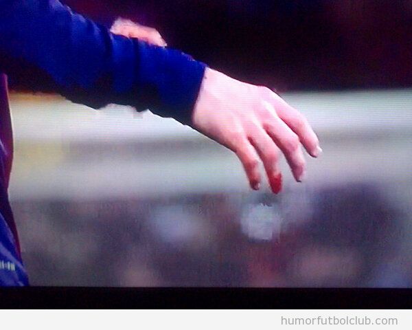 Imagen del dedo de Messi sangrando en el Bara Sevilla
